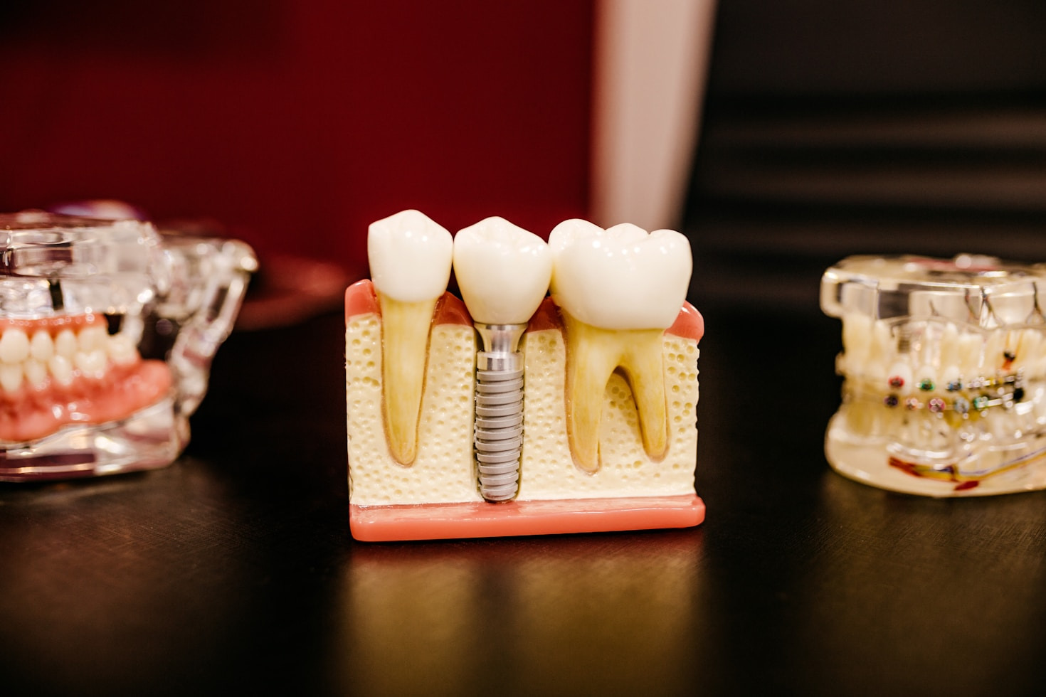 Pourquoi choisir une clinique dentaire premium